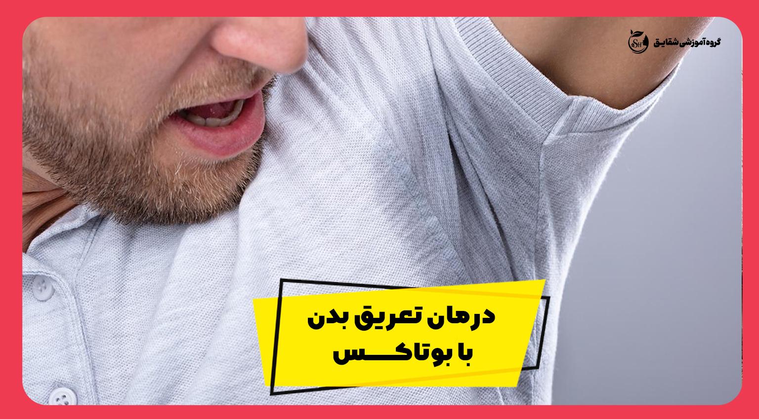 درمان تعریق بدن با بوتاکس ! 7 عارضه بسیار کمیاب بوتاکس که باید بدانید