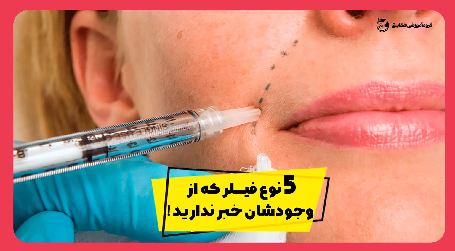 فیلر چیست؟ 5 نوع فیلر که از وجودشان خبر ندارید !!